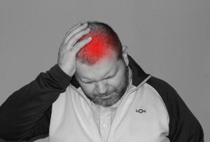 What Are Cluster Headaches