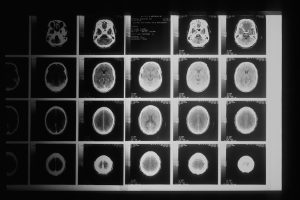 https://medicalhealthcare24.com/what-are-the-side-effects-of-chemotherapy/