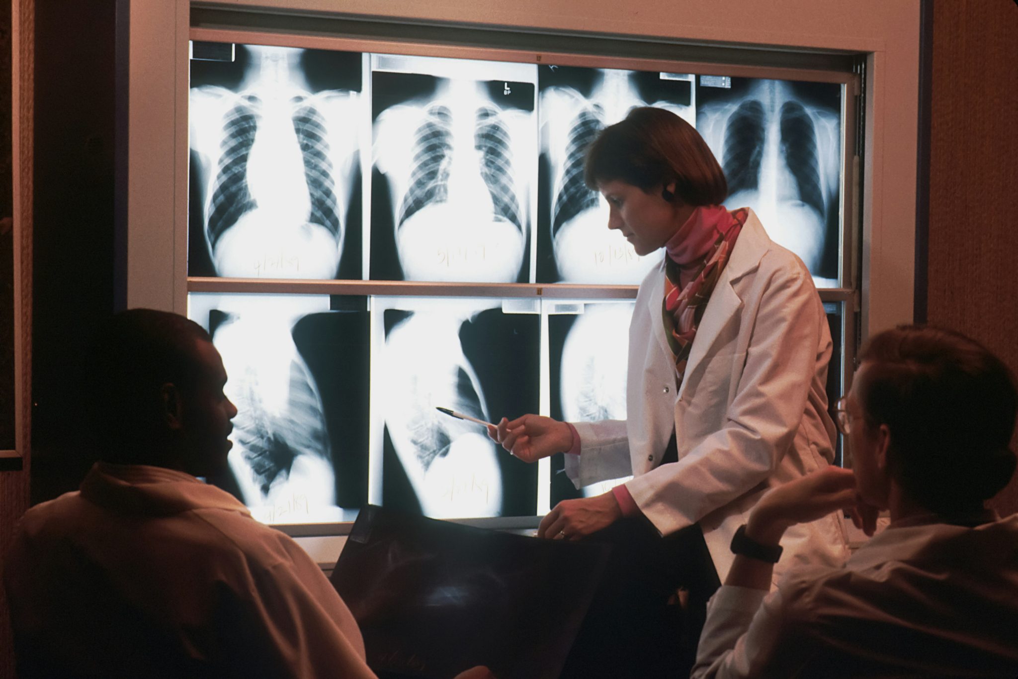 Early signs and symptoms of lung cancer