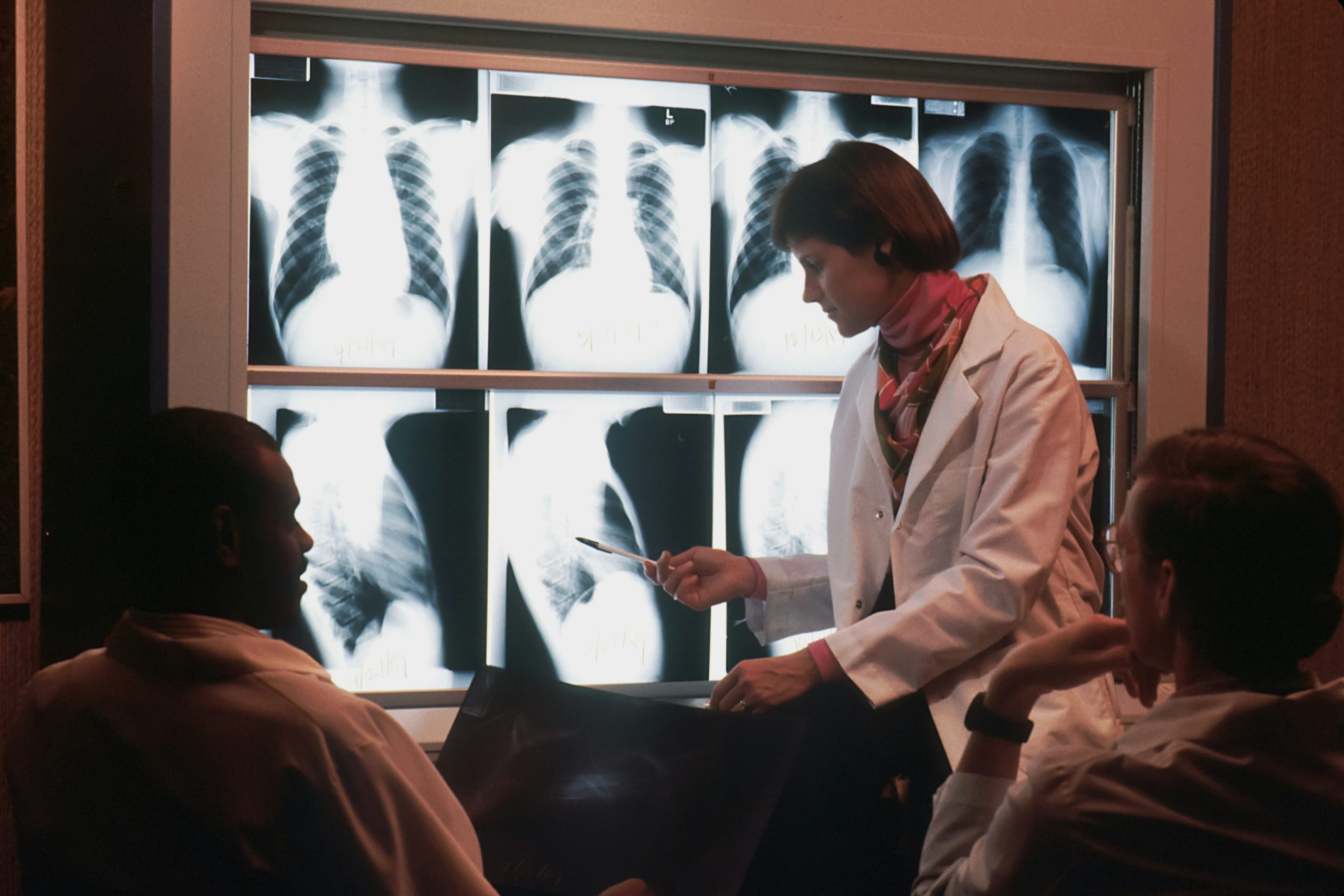 Early Signs and Symptoms of Lung Cancer! Early Detection Matters