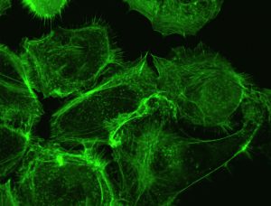 American Joint Committee on Cancer (AJCC)