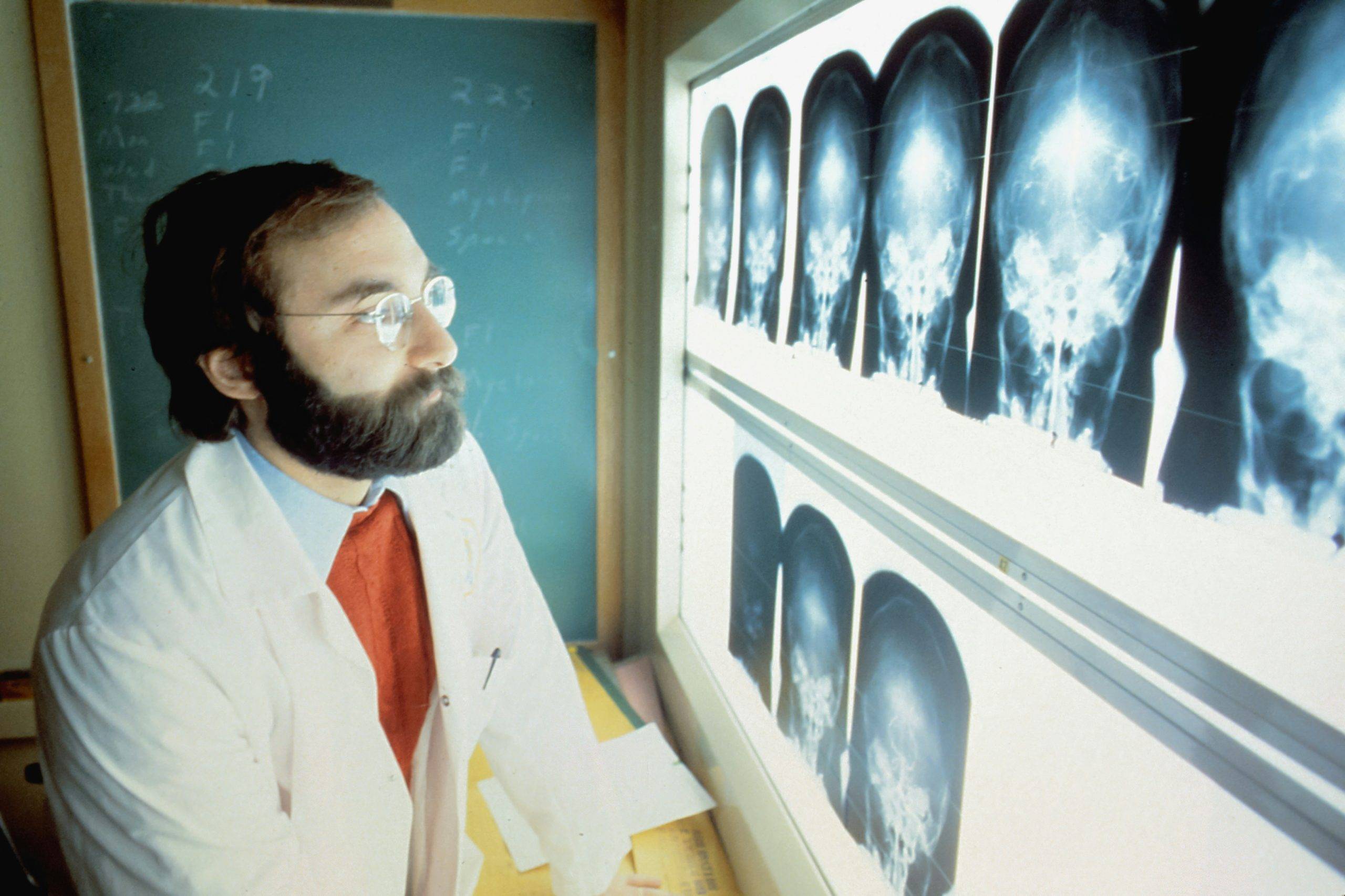 What are the Stages of Cancer? AJCC