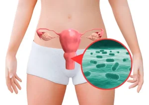 How to cure Bacterial Vaginosis