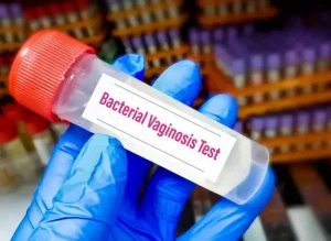 How to cure Bacterial Vaginosis