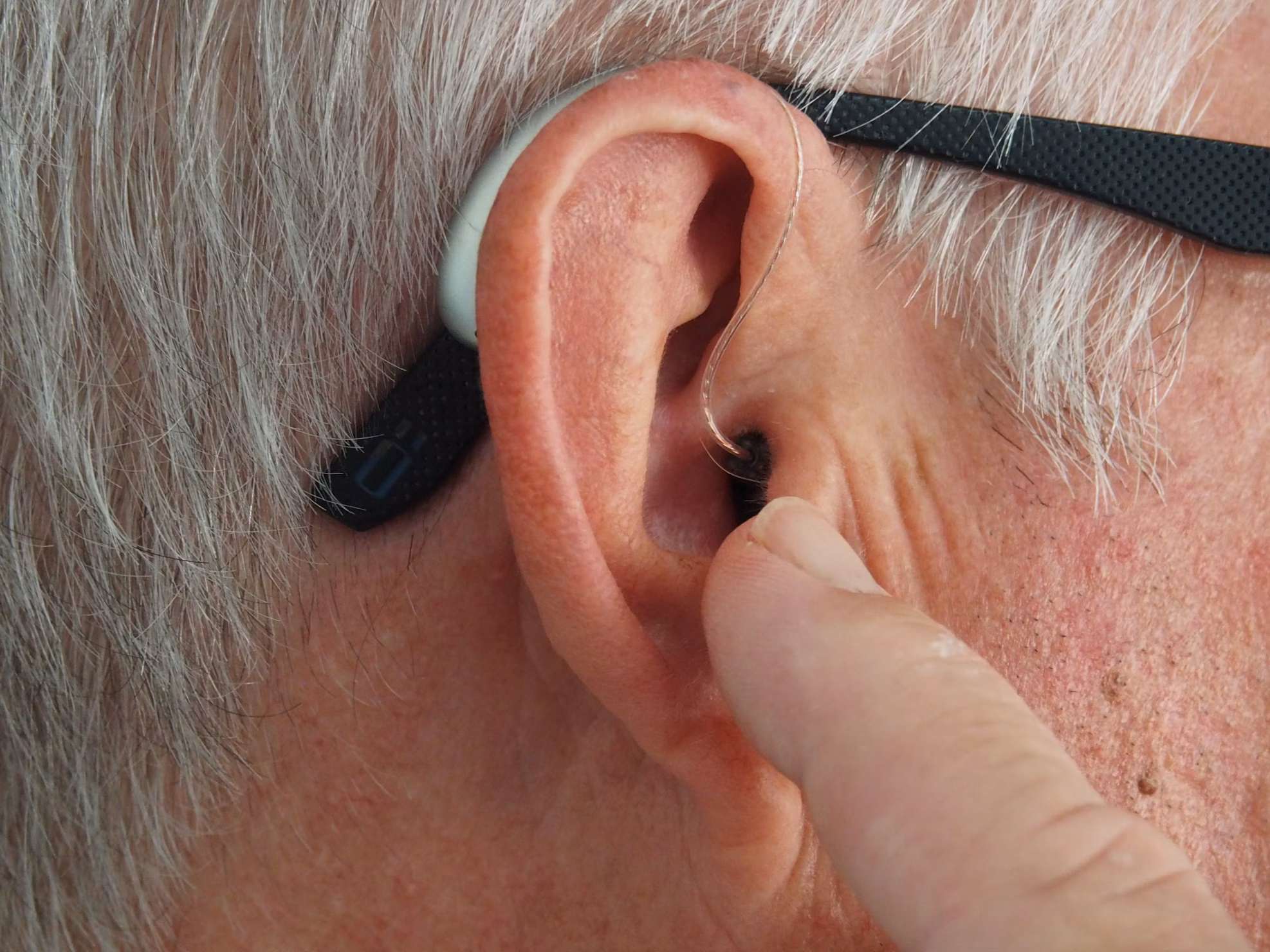 Vancomycin Side Effects Hearing Loss! Serious adverse effects